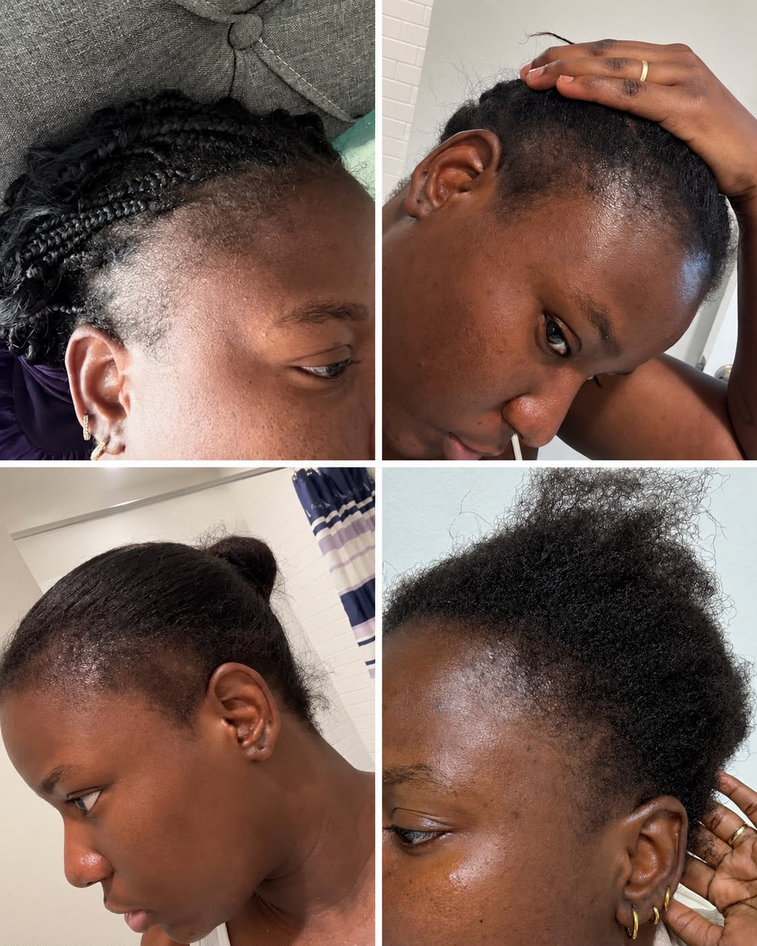 HAIR GROWTH SPRAY